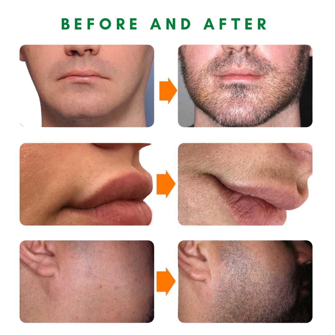 Irish Supply, RuggedRoll™ Beard Growth Roller