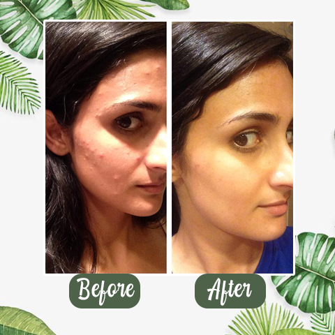 Irish Supply, PORELESS- Deep Cleanse Green Tea Mask