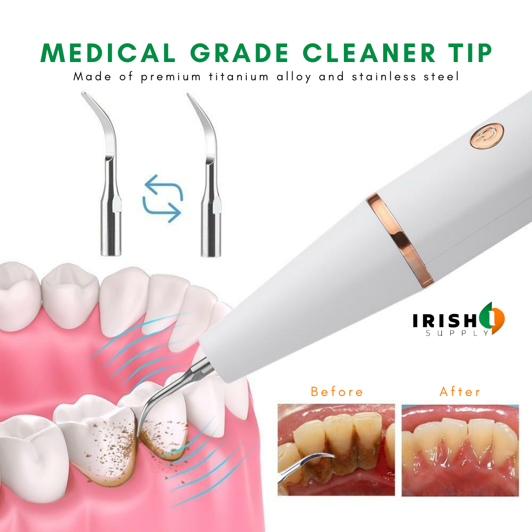 Irish Supply, CLEANSONIC, Revolutionary Ultrasonic Tartar Removal Tool