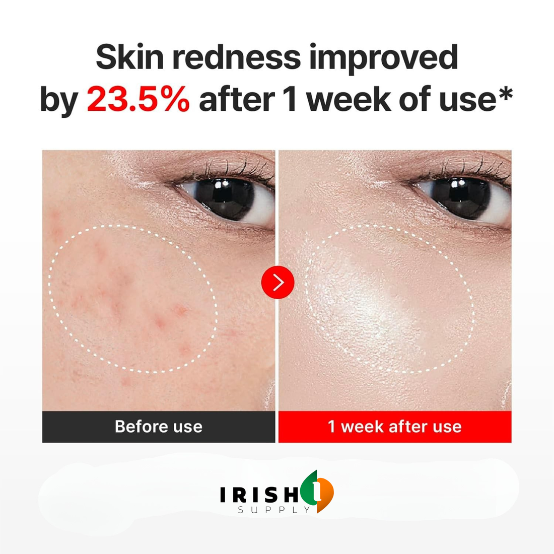 VAELORA Skin-Renewing Anti-Aging Cream with Cica & Hyaluronic Acid (50 ml)