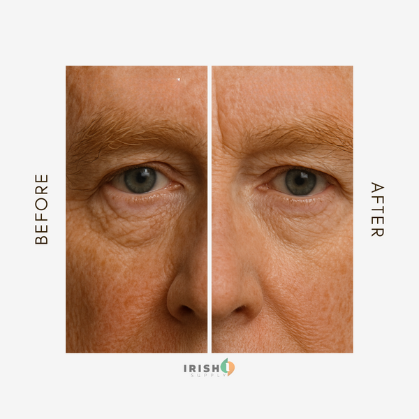 <p>Bright Eyes, No Matter the Day</p>