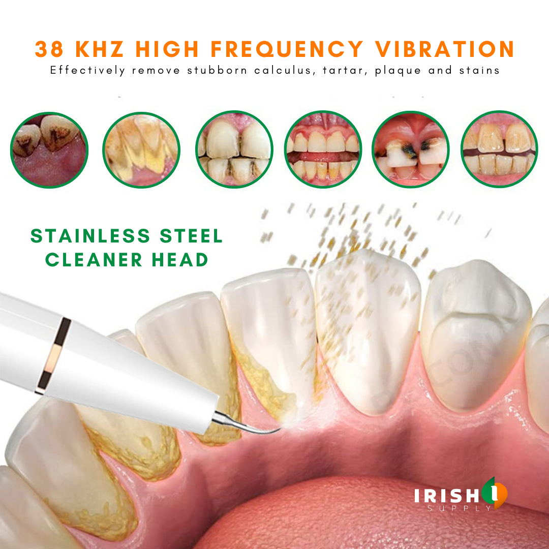 Irish Supply, CLEANSONIC, Revolutionary Ultrasonic Tartar Removal Tool