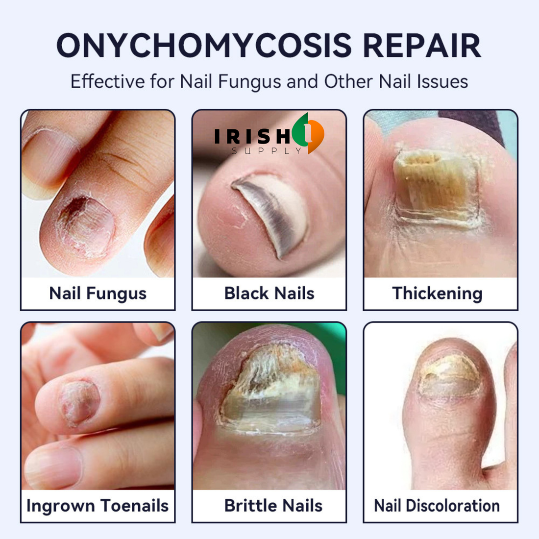 PUREFIX Deep Renewal Antifungal Treatment Pen