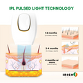 Irish Supply, Vanera™ IPL Laser Hair Remover