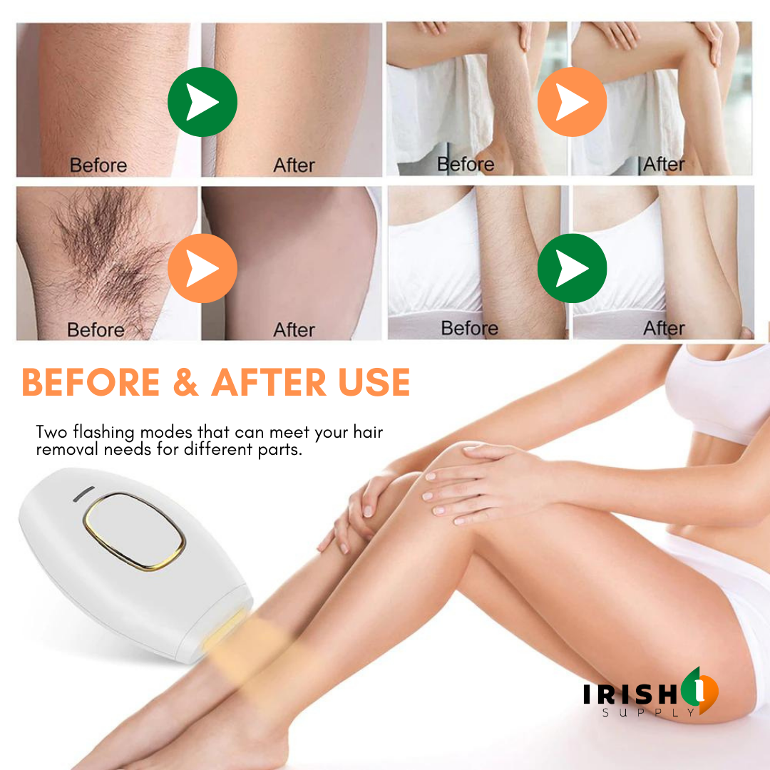 Irish Supply, Vanera™ IPL Laser Hair Remover